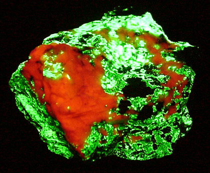 Willemite, Calcite, Franklinite from Sterling Mine, Ogdensburg, Sterling Hill, Sussex County, New Jersey (Type Locality for Franklinite)