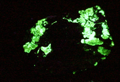 Brandtite and Sarkinite on Franklinite and Willemite from Sterling Mine, Ogdensburg, Sterling Hill, Sussex County, New Jersey (Type Locality for Franklinite)