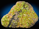 Pyromorphite from Grube Beim Stollen, Grafenwhr, Oberpfalz, Bayern (Bavaria), Germany